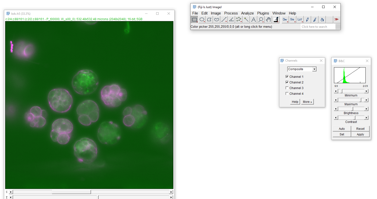 Brightness and Contrast settings